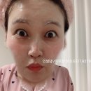 루나인셀덤 | 인셀덤 사용후기 [솔직한 루나씨]