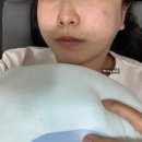애프터스킨 | 천호동피부과 얼굴 줄기세포주사 스킨부스터 내돈내산 효과 통증 전후 비포애프터 후기