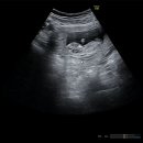 아들,딸 각도법 문의드려용!!!🥹 이미지