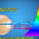 블루라이트 이미지