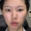 이상지 | 집에서 관리하는 홈모드 써마리프트 내돈내산 홈모드후기 #4