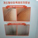 예지인피부과의원 | 선릉역 피부과 '팔꿈치, 겨드랑이 색소침착 레이저 &amp; 피코프락셀' 2회차 후기