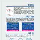 모래알 같은 느낌 렌즈삽입술 사실 너무 긴장했네요 이미지