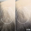 [경기/군포] 군포 탈모관리, 리턴스킨 2차 3차 내돈내산 찐후기!!!