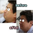 [공지] 광흥창피부과, 쁘띠1만건 시술의 온앤업클리닉 전후사진과 후기&amp;잡지 모음