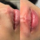 당진 인중왁싱 ❛네일도맑음뷰티❜에서 2회차 후기