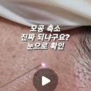 플라즈마뷰티플러스업
