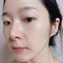 피씨케어 이미지