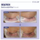 블라써밍 이미지