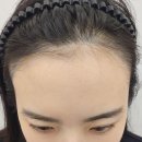 흥미 헤어라인