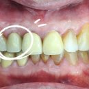 새빛치과기공소 이미지