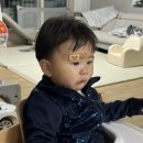 신세계성형외과 | 12개월 아기 눈썹 위 찢어짐 사고 | 광주 신세계 성형외과 이용후기 | 상무지구 리노 성형외과 비교