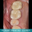 오션기공소 이미지