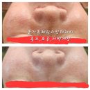 영진광택 이미지