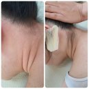 고은정헤어라인