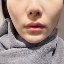 광화문헤리티크피부과의원 네이버블로그