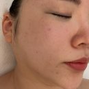 해운대 피부관리 1:1 프라이빗 공간에서 V라인 예신관리 베니어스파 스톤앤뱀부 스페셜힐링관리