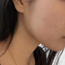 11620-15-73-5 | 복부 뱃살 관리 &amp; 셀프 고주파 다이어트 30분 솔직 후기 | 힐바나