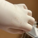 한주화장품 | 마산 에스테틱 제시뷰티 "네오더마필" 관리 후기