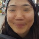 스노우의원 이미지