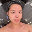 가림피부관리 이미지