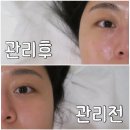 지에스25반포서래마을점 | 서래마을에스테틱 발란스테라피 수기관리 잘하는 아운 솔직후기