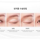 리엔장성형외과의원