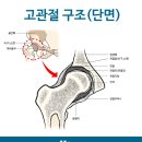 고관절수술//고관절인공관절//고관절인공관절치환술 이미지