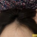 오투피부손질