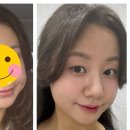 오늘,맑음의원 네이버블로그