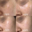 청담모네의원 | 💉 청담모네의원 줄기세포주사 / 내돈내산 리얼 후기