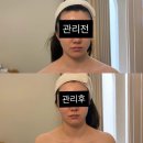 용산-245 | 신용산 온화 에스테틱 피부 경락관리 (두피테라피, 수분관리, 데콜테 등)