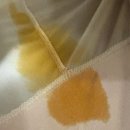 미즈러브여성비뇨의학과의원 | 다파원엠 복용 2개월 후 부작용인가? (feat. 혐짤사진주의)