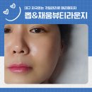 뷰티라운지J | 대구각질관리 뽑&채움by_J 뷰티라운지 물광필관리 후기