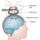 판교성모숲정신건강의학과의원 | TMS