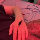 여의나루로 | 여의도 이지한의원 손가락 인대 방문 후기