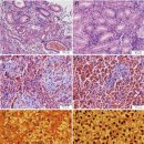 중국미꾸라지의 Streptococcus dysgalactiae와 S. agalactiae 이미지