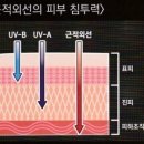 글라시스트 이미지
