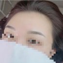 예쁜눈썹 이미지