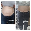 중앙카클리닉 | 부산 해운대 비만클리닉 워킹맘 직장인 술살 다이어트 육아 출산후 센텀 복부 지방추출주사 4주차 한달...