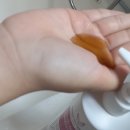 글로벌린