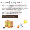 유로성형외과，피부과 | 유로성형외과 이클립리프팅 후기에요~ #1