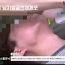 위플러스메디칼 | 수원남자수염제모, 매일 하는 면도가 부담스럽다면 젠틀맥스프로플러스