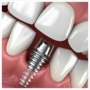 365아홉가지약속치과병원 | 임플란트부터 소아치과까지, 탕정에서 신뢰받는 치과, 365 아홉가지 약속 치과 병원!