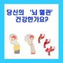 주식회사 스콜 이미지