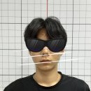 울산동구 연세크리스탈치과 아이돌 준비생의 턱치료