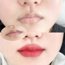 SI뷰티 | 대구 달서구 월성동 입술타투 플로우뷰티 후기
