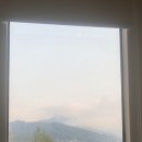 하종원 | [서울대신장이식] 로봇수술 후기(ft.하종원교수님)