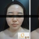 맘스퀸