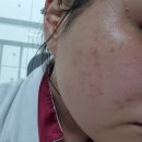 오일스팟 이미지